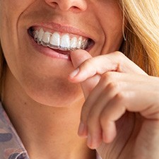 A woman placing an Invisalign tray in her mouth