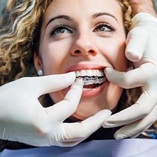 A dentist placing a patient’s Invisalign tray