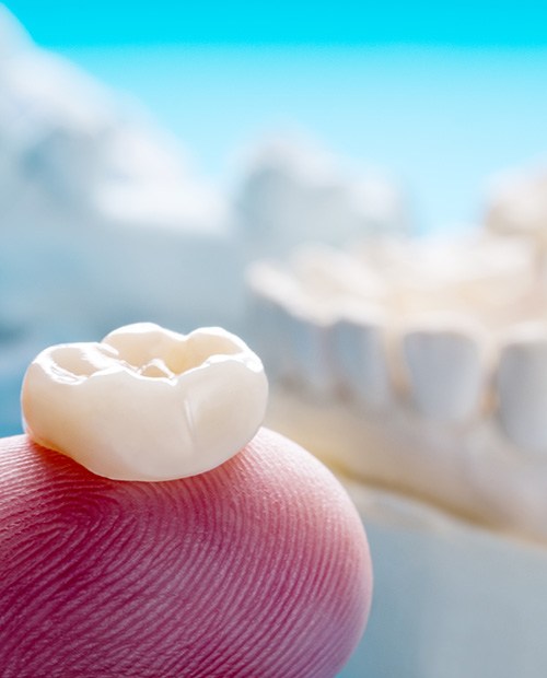 Dental crown resting on a fingertip